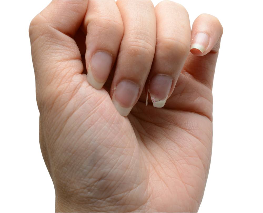 sonhar com unha quebrada