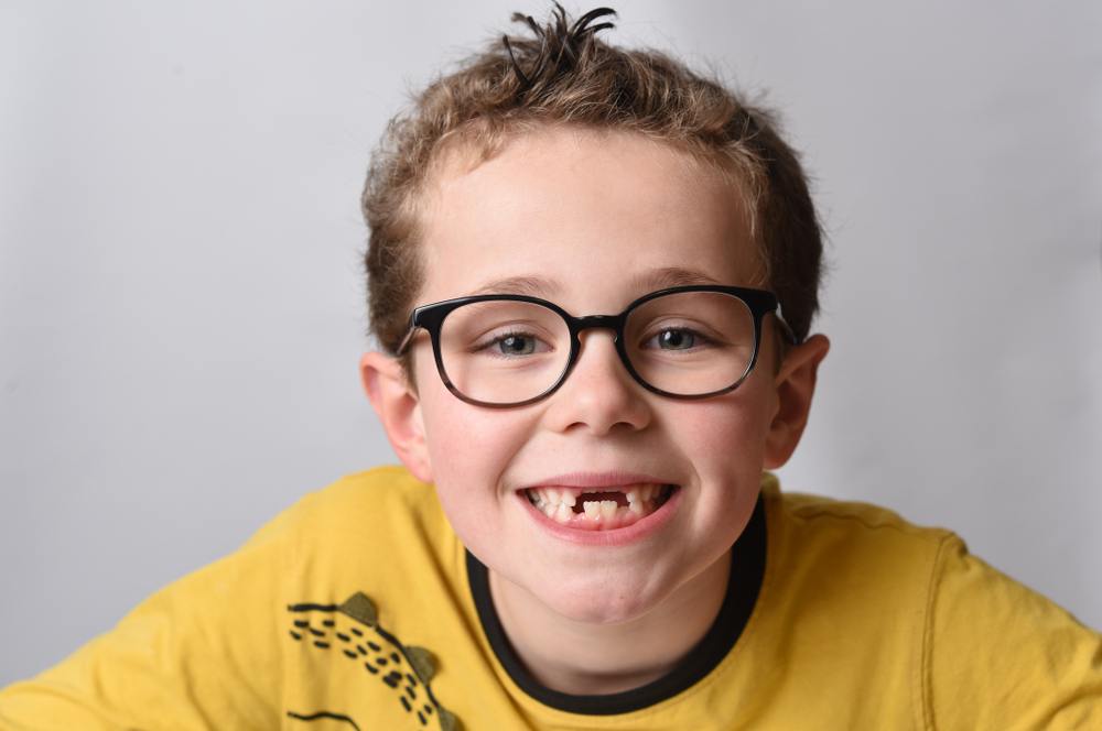 sonhar com dentes caindo