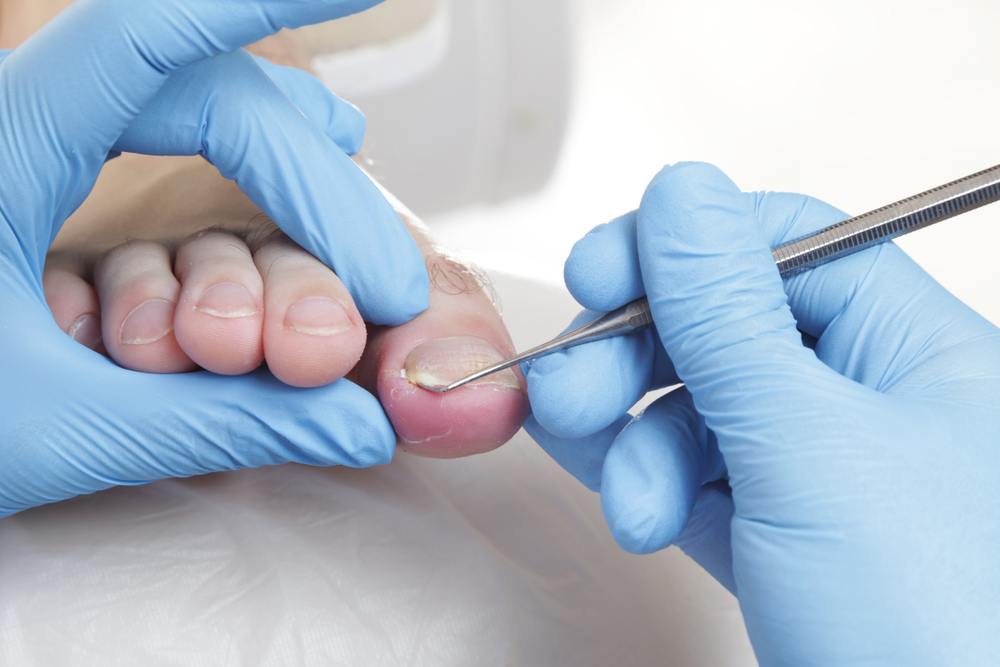 O que significa sonhar com unha quebrada?